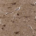 SIRT5 Antibody in Immunohistochemistry (Paraffin) (IHC (P))