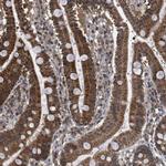 SIRT5 Antibody in Immunohistochemistry (Paraffin) (IHC (P))