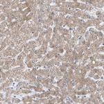 SIRT5 Antibody in Immunohistochemistry (Paraffin) (IHC (P))