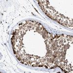 SIRT5 Antibody in Immunohistochemistry (Paraffin) (IHC (P))