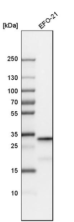 SIRT5 Antibody in Western Blot (WB)