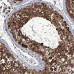 SPAG5 Antibody in Immunohistochemistry (Paraffin) (IHC (P))