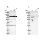 SPATA20 Antibody in Western Blot (WB)