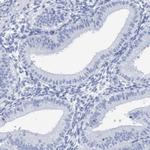 PERP Antibody in Immunohistochemistry (Paraffin) (IHC (P))