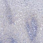 PERP Antibody in Immunohistochemistry (Paraffin) (IHC (P))