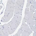 PERP Antibody in Immunohistochemistry (Paraffin) (IHC (P))