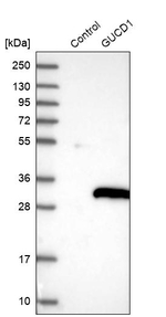 C22orf13 Antibody in Western Blot (WB)