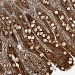 EXOC7 Polyclonal Antibody