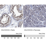 CALCOCO2 Antibody in Immunohistochemistry (Paraffin) (IHC (P))