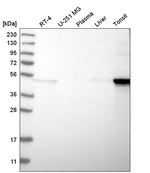 Cytokeratin 14 Antibody in Western Blot (WB)