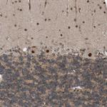 ZNF366 Antibody in Immunohistochemistry (Paraffin) (IHC (P))