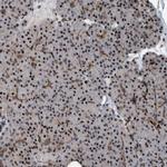 ZNF366 Antibody in Immunohistochemistry (Paraffin) (IHC (P))
