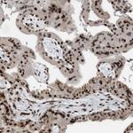 ZNF366 Antibody in Immunohistochemistry (Paraffin) (IHC (P))