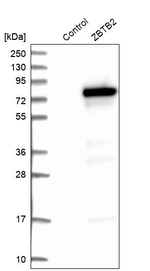 ZBTB2 Antibody in Western Blot (WB)
