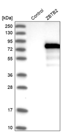 ZBTB2 Antibody in Western Blot (WB)