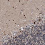 PINX1 Polyclonal Antibody