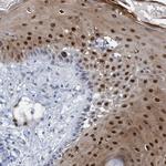 PINX1 Antibody in Immunohistochemistry (Paraffin) (IHC (P))