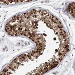 PINX1 Antibody in Immunohistochemistry (Paraffin) (IHC (P))