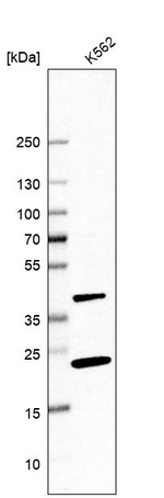 PINX1 Antibody in Western Blot (WB)