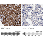 DECR1 Antibody in Immunohistochemistry (Paraffin) (IHC (P))