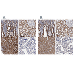 DECR1 Polyclonal Antibody