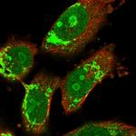 CENTG1 Polyclonal Antibody