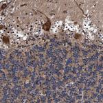 CENTG1 Antibody in Immunohistochemistry (Paraffin) (IHC (P))