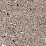 CENTG1 Antibody in Immunohistochemistry (Paraffin) (IHC (P))