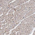 CENTG1 Antibody in Immunohistochemistry (Paraffin) (IHC (P))