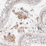 Protein S Antibody in Immunohistochemistry (Paraffin) (IHC (P))