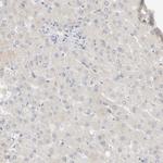 PIST Antibody in Immunohistochemistry (Paraffin) (IHC (P))