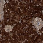 CREB3L1 Antibody in Immunohistochemistry (Paraffin) (IHC (P))