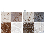 HRD1 Polyclonal Antibody