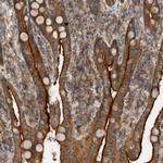SCARA5 Polyclonal Antibody