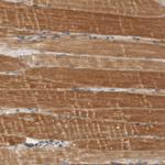 SCARA5 Antibody in Immunohistochemistry (Paraffin) (IHC (P))