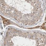 SCARA5 Antibody in Immunohistochemistry (Paraffin) (IHC (P))