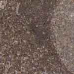 SCARA5 Antibody in Immunohistochemistry (Paraffin) (IHC (P))