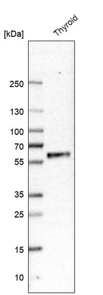 GFR alpha-2 Antibody in Western Blot (WB)