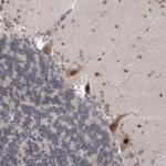 MTBP Antibody in Immunohistochemistry (Paraffin) (IHC (P))