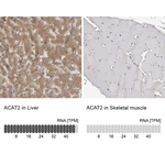 ACAT2 Antibody in Immunohistochemistry (Paraffin) (IHC (P))
