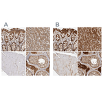 ACAT2 Antibody in Immunohistochemistry (Paraffin) (IHC (P))