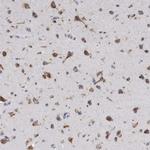 AKAP9 Antibody in Immunohistochemistry (Paraffin) (IHC (P))