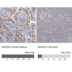 AKAP9 Antibody in Immunohistochemistry (Paraffin) (IHC (P))