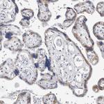 AKAP9 Antibody in Immunohistochemistry (Paraffin) (IHC (P))