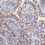 AKAP9 Antibody in Immunohistochemistry (Paraffin) (IHC (P))