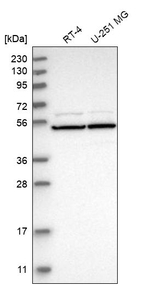 RAD23A Antibody in Western Blot (WB)