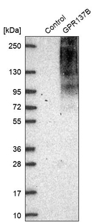 GPR137B Antibody in Western Blot (WB)