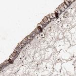 VLK Polyclonal Antibody