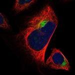 ALS2CR2 Polyclonal Antibody