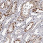 ALS2CR2 Antibody in Immunohistochemistry (Paraffin) (IHC (P))